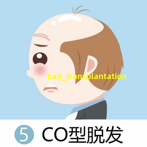 hair_transplantation