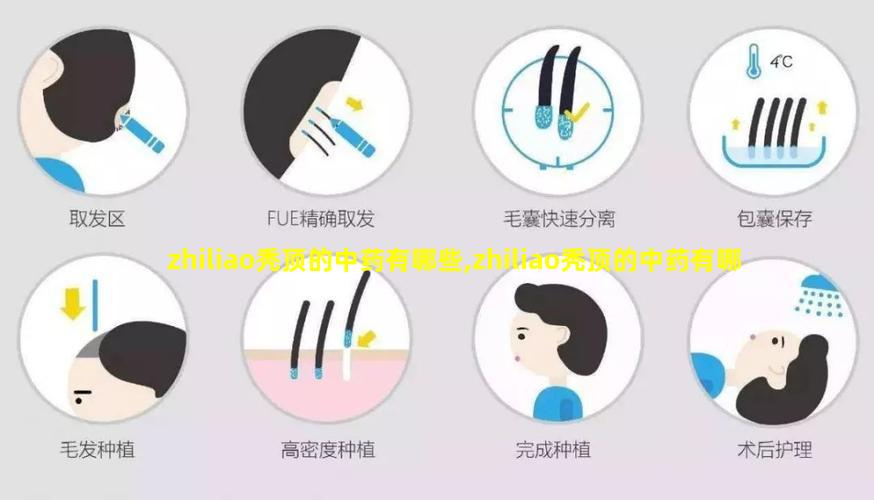 zhiliao秃顶的中药有哪些,zhiliao秃顶的中药有哪些图片
